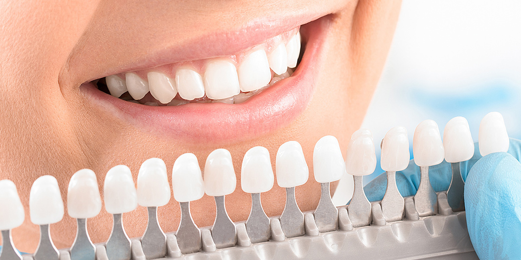 Cosmetic Dentistry - Dental Implants, Bonding, Crowns | Hamburg Dental Care