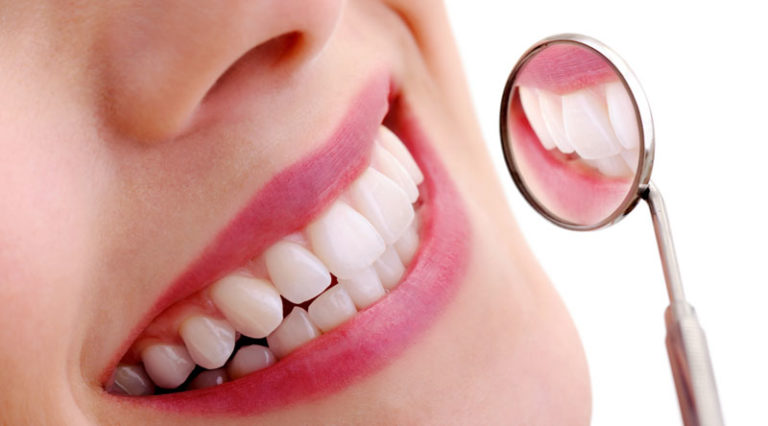Read more about the article A Guide to Dental Bonding