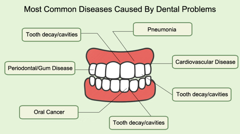 How Do Dental Problems Affect Your Overall Health?