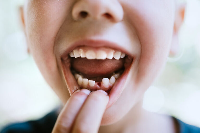 Read more about the article What Every Parent Needs to Know About Their Child’s Teeth